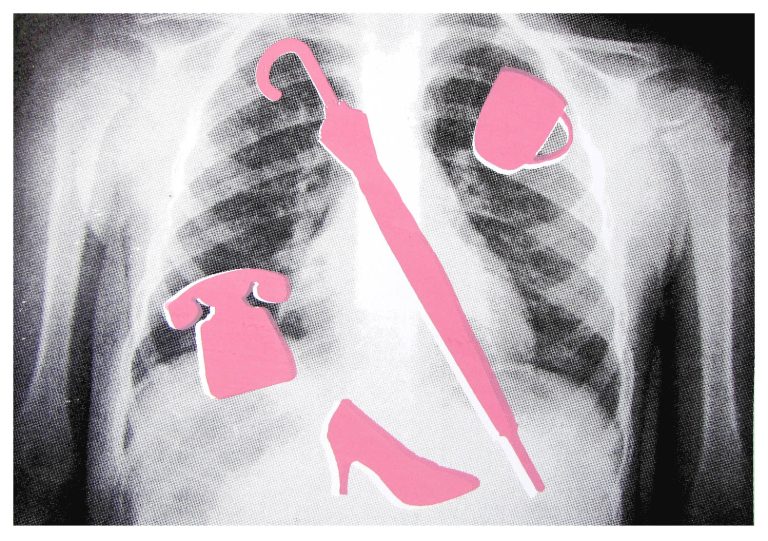 basia braczkowska kl iii sito